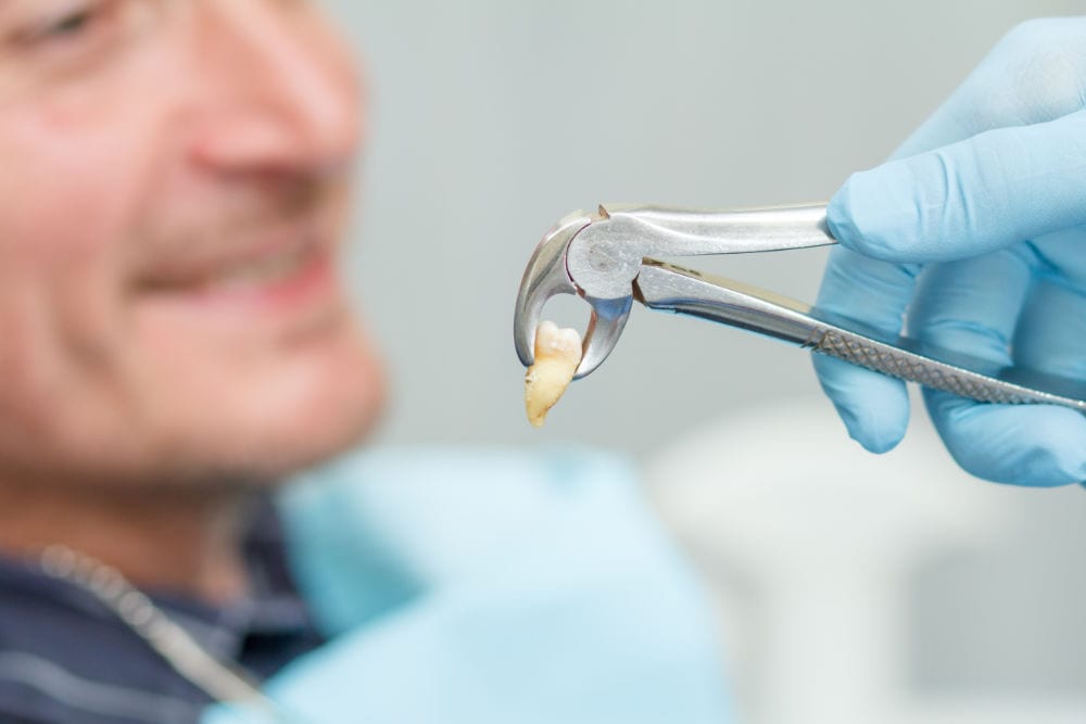 A dentist holding an extracted tooth in forceps beside a smiling patient