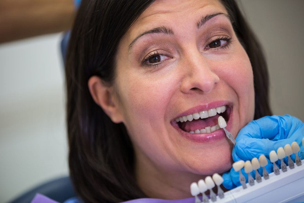 A dentist matching a veneer shade to a smiling patient's teeth
